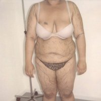 Voor behandeling - vooraanzicht